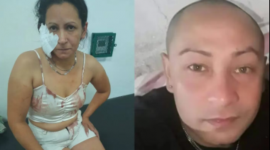 Detienen al hombre que mordió a su pareja y le arrancó un pedazo de oreja en Avellaneda